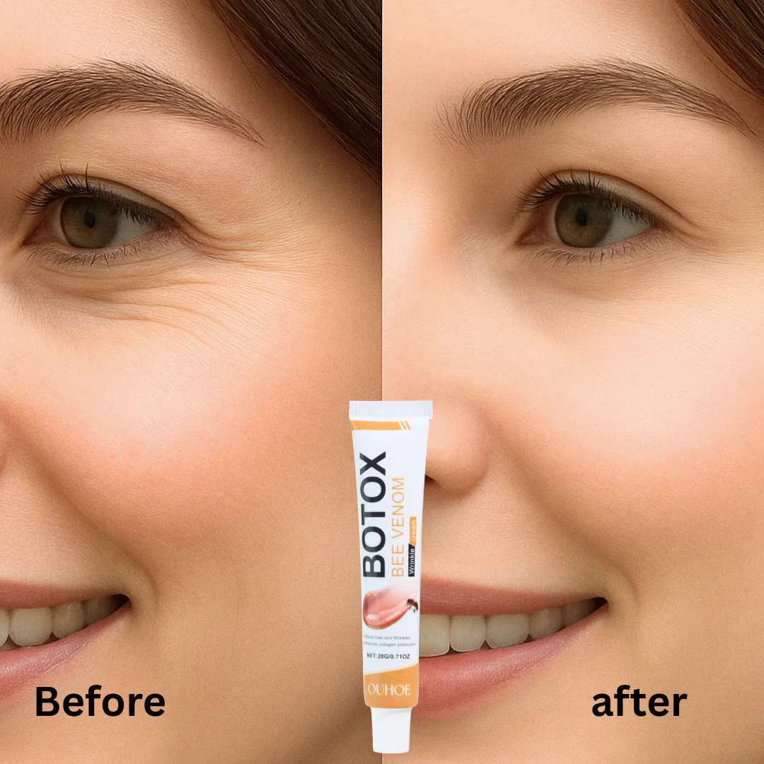 Botox BeeVenom Anti Wrinkle Cream – BUY 1 GET 1 - Image 2