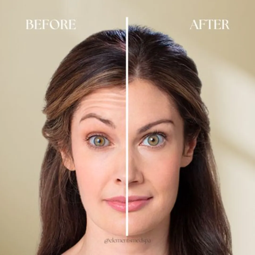 Celimax The Vita-A Retinal Shot Tightening Booster 15ml (Korean stock) - Image 5