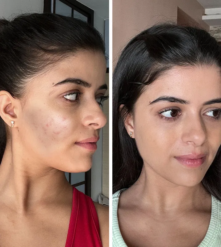 Celimax The Vita-A Retinal Shot Tightening Booster 15ml (Korean stock) - Image 2