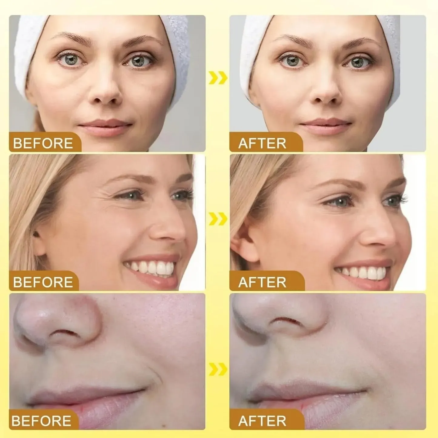 Botox BeeVenom Anti Wrinkle Cream – BUY 1 GET 1 - Image 3