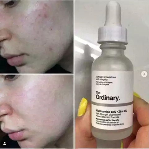 Ordinary Serum Niacinamide 10% + Zinc 1% - Image 2